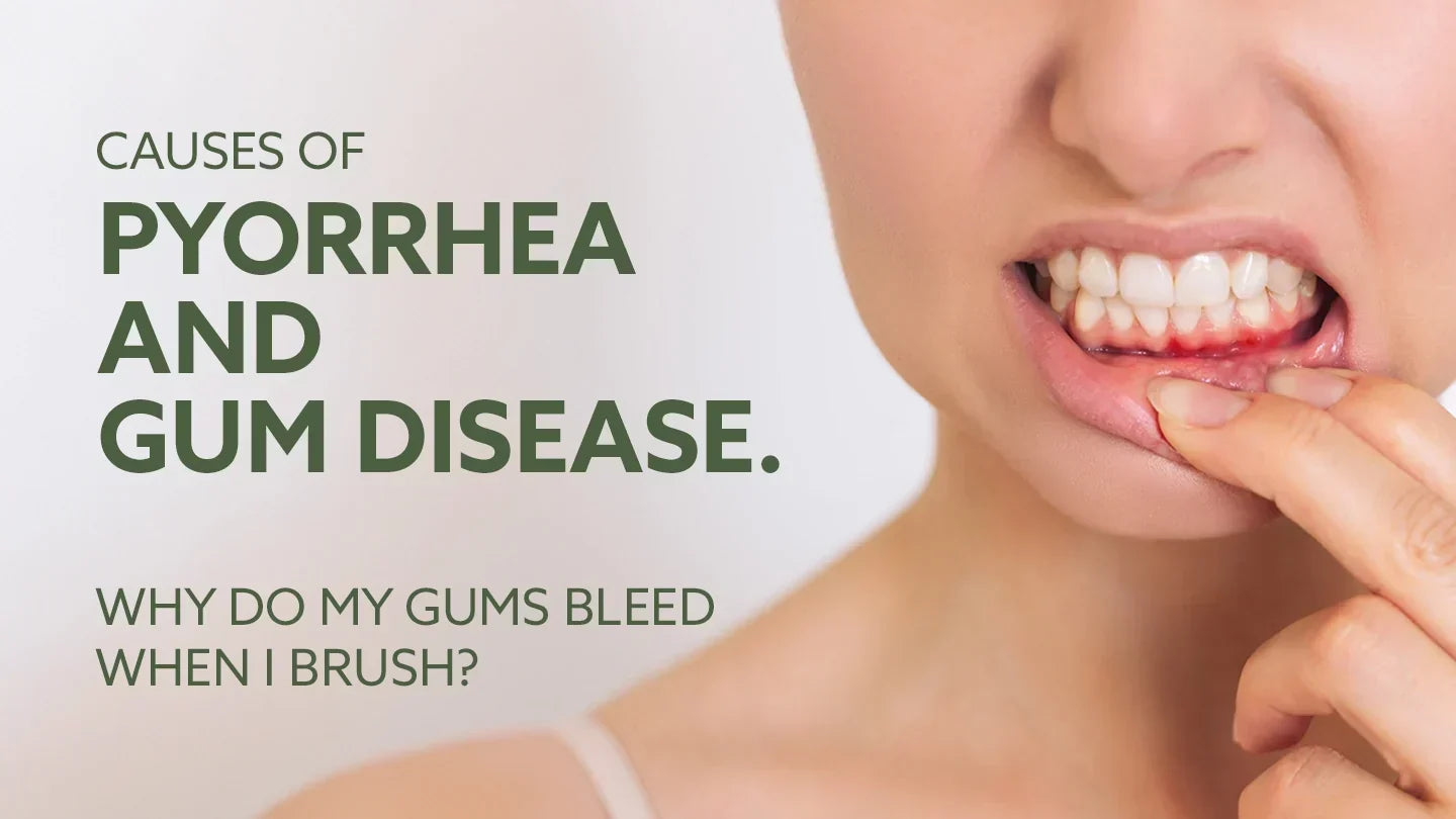 Why Gums Bleed When Brushing: Causes, Gum Disease & Pyorrhea