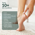 Load image into Gallery viewer, Mayaderm Multipurpose Cream
