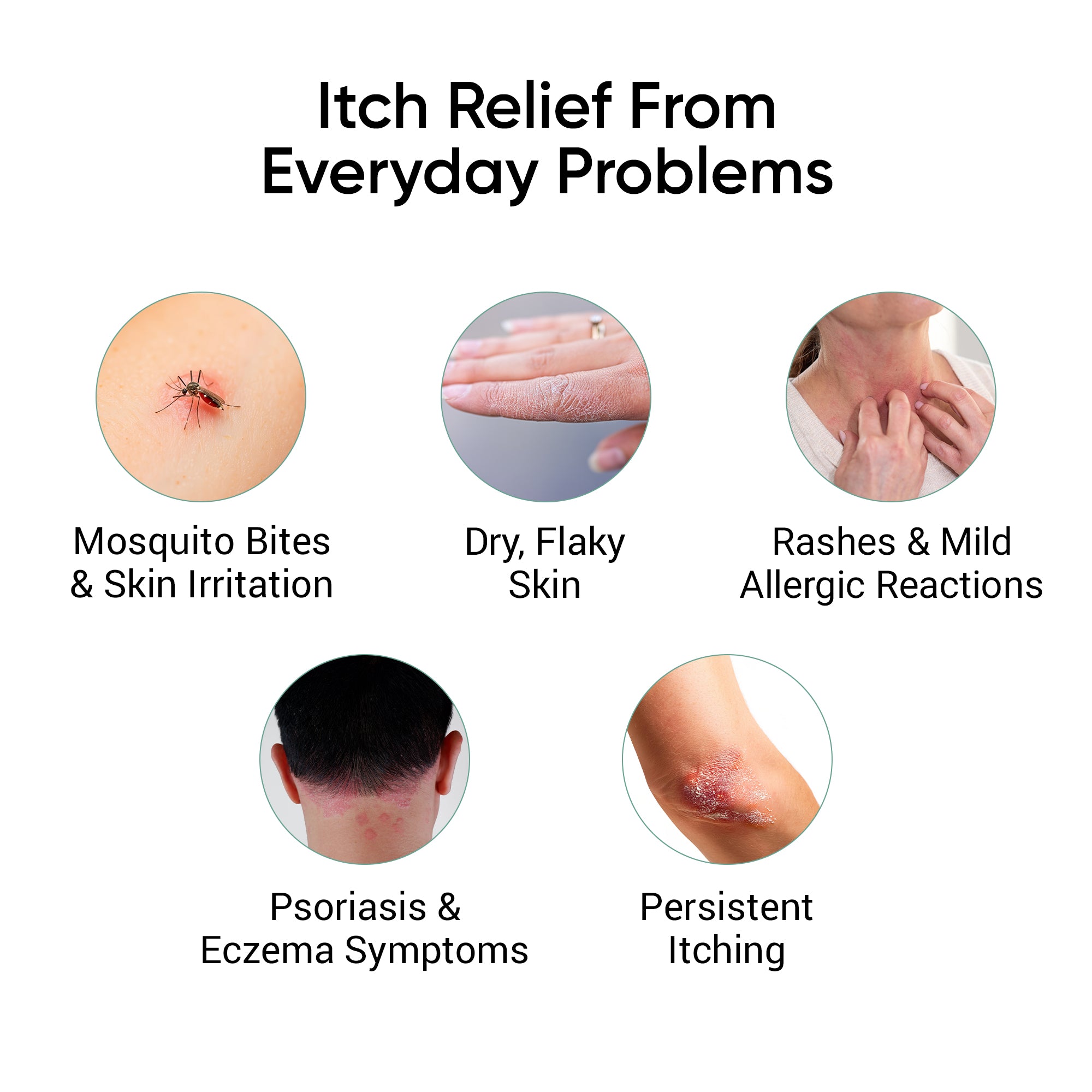 Dadaz Pharma Itch Relief Spray