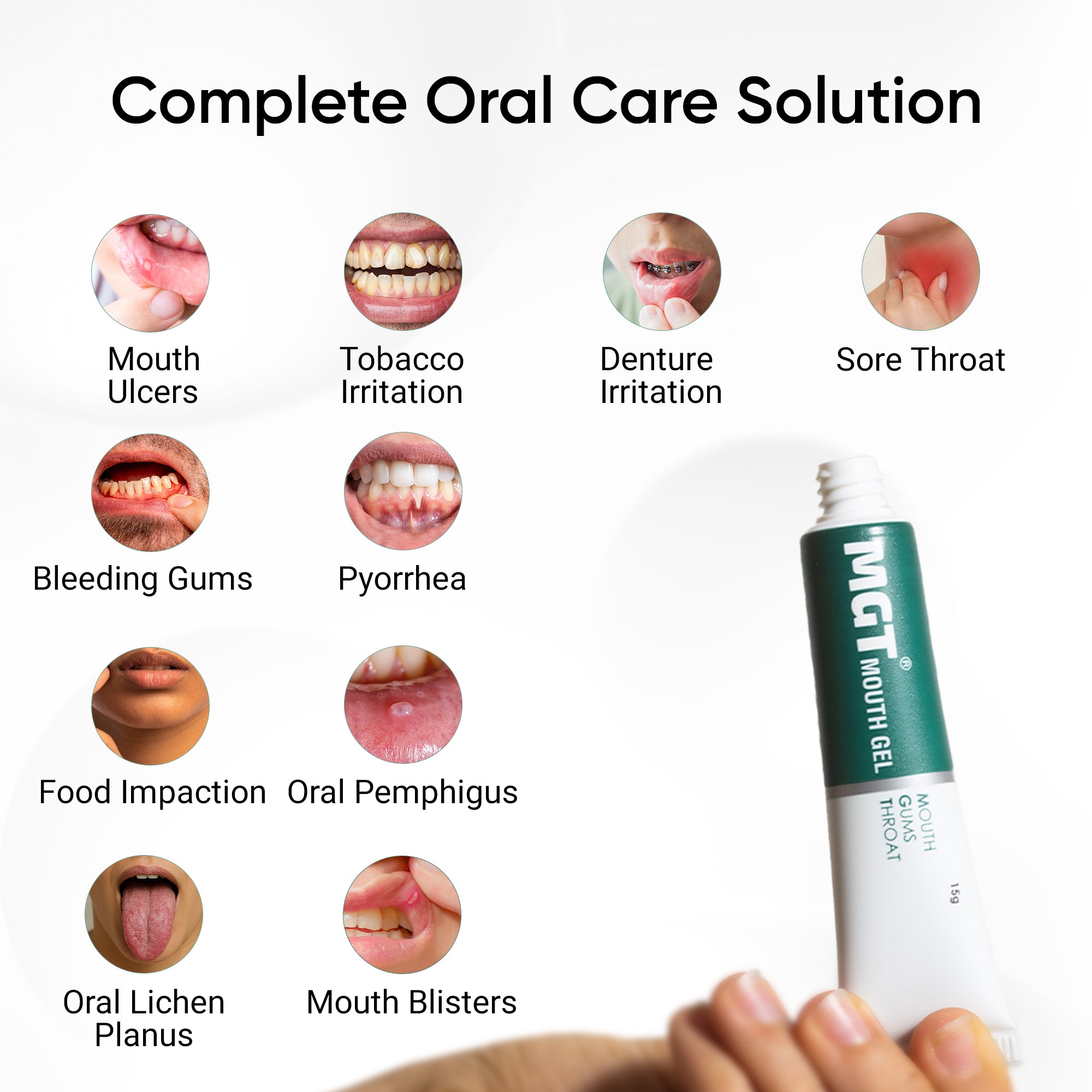MGT Mouth Gel